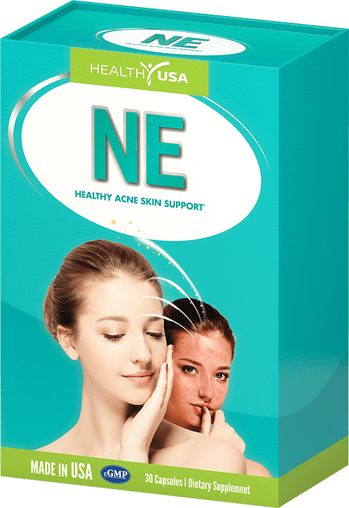 NE