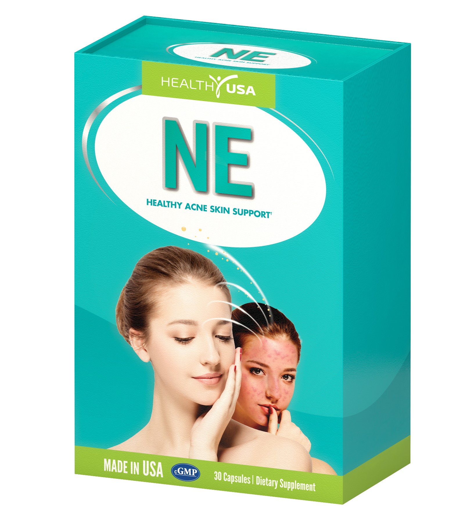 Ne – sạch mụn, mịn da